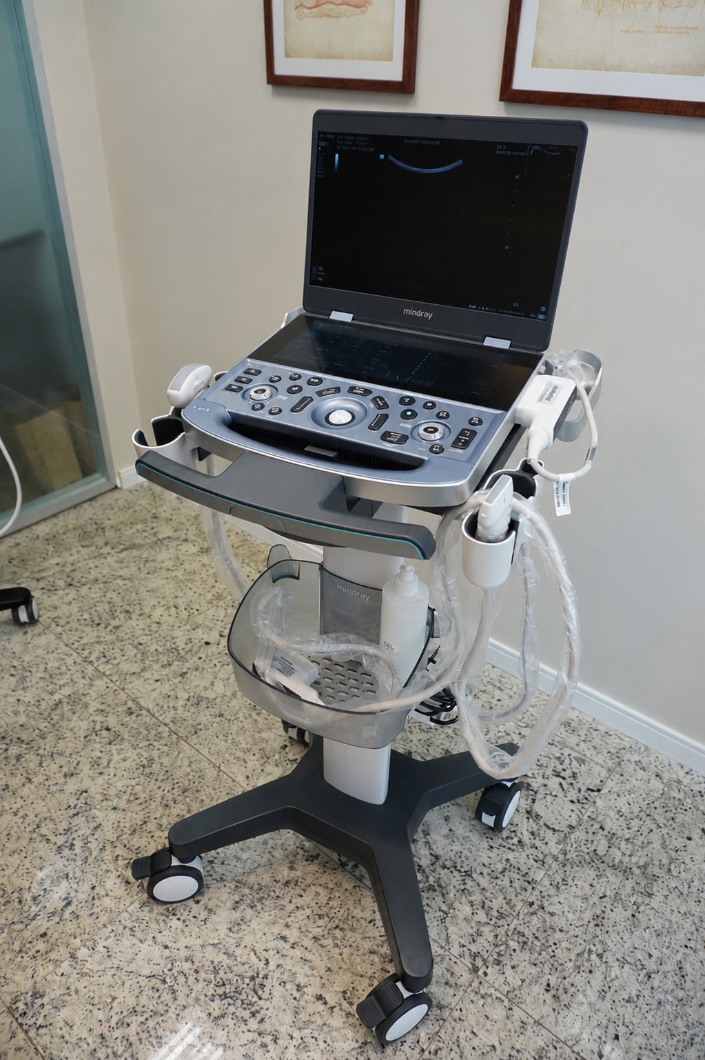 Ultrassom Mindray para diagnóstico dermatológico e planejamento de procedimentos